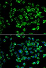 PSMD13 Antibody in Immunocytochemistry (ICC/IF)