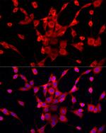 PEX5 Antibody in Immunocytochemistry (ICC/IF)