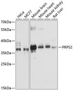 PRPS2 Antibody in Western Blot (WB)