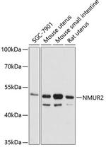 NMUR2 Antibody in Western Blot (WB)