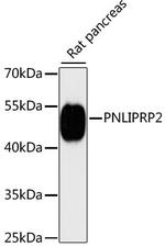 PNLIPRP2 Antibody in Western Blot (WB)
