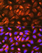 RAP Antibody in Immunocytochemistry (ICC/IF)