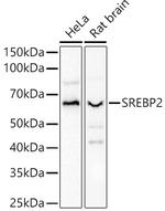 SREBP2 Antibody in Western Blot (WB)