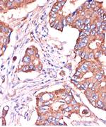 IFITM3 Antibody in Immunohistochemistry (Paraffin) (IHC (P))