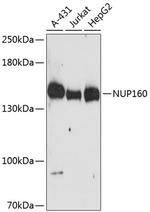 NUP160 Antibody in Western Blot (WB)