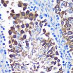 SENP1 Antibody in Immunohistochemistry (Paraffin) (IHC (P))