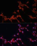 SLC25A38 Antibody in Immunocytochemistry (ICC/IF)