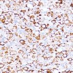 ACAT1 Antibody in Immunohistochemistry (Paraffin) (IHC (P))