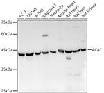 ACAT1 Antibody in Western Blot (WB)