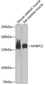 MYBPC2 Antibody in Western Blot (WB)