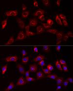 COL1A1 Antibody in Immunocytochemistry (ICC/IF)