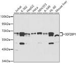 IGF2BP1 Antibody in Western Blot (WB)