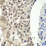 SSRP1 Antibody in Immunohistochemistry (Paraffin) (IHC (P))