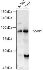 SSRP1 Antibody in Western Blot (WB)