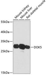 DOK5 Antibody in Western Blot (WB)