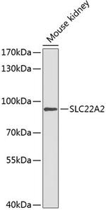 SLC22A2 Antibody in Western Blot (WB)