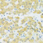 SLC37A4 Antibody in Immunohistochemistry (Paraffin) (IHC (P))