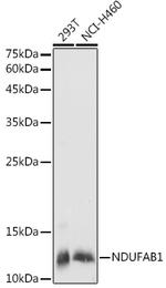 NDUFAB1 Antibody in Western Blot (WB)