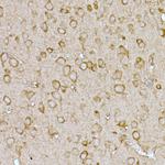 SLC7A1 Antibody in Immunohistochemistry (Paraffin) (IHC (P))