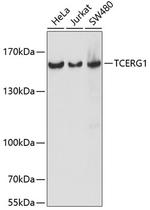 CA150 Antibody in Western Blot (WB)