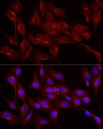 LDLR Antibody in Immunocytochemistry (ICC/IF)