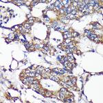 SLIRP Antibody in Immunohistochemistry (Paraffin) (IHC (P))