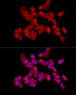 Collagen II Antibody in Immunocytochemistry (ICC/IF)