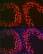 DDX4 Antibody in Immunocytochemistry (ICC/IF)