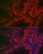 DDX4 Antibody in Immunocytochemistry (ICC/IF)