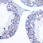 DDX4 Antibody in Immunohistochemistry (Paraffin) (IHC (P))