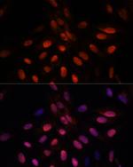 TPI1 Antibody in Immunocytochemistry (ICC/IF)