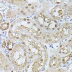 TPI1 Antibody in Immunohistochemistry (Paraffin) (IHC (P))