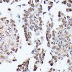 TPI1 Antibody in Immunohistochemistry (Paraffin) (IHC (P))