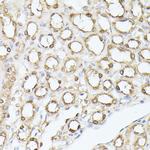 TPI1 Antibody in Immunohistochemistry (Paraffin) (IHC (P))