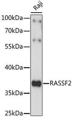 RASSF2 Antibody in Western Blot (WB)