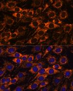 ACAA2 Antibody in Immunocytochemistry (ICC/IF)