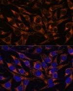 ACAA2 Antibody in Immunocytochemistry (ICC/IF)