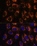 ACAA2 Antibody in Immunocytochemistry (ICC/IF)