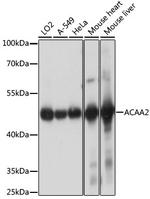 ACAA2 Antibody in Western Blot (WB)