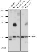 MED31 Antibody in Western Blot (WB)