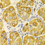 RAP Antibody in Immunohistochemistry (Paraffin) (IHC (P))