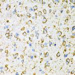 RAP Antibody in Immunohistochemistry (Paraffin) (IHC (P))