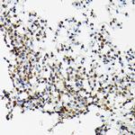 SRSF2 Antibody in Immunohistochemistry (Paraffin) (IHC (P))