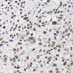 SRSF2 Antibody in Immunohistochemistry (Paraffin) (IHC (P))