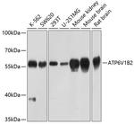 ATP6V1B2 Antibody in Western Blot (WB)