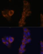 RPL23A Antibody in Immunocytochemistry (ICC/IF)