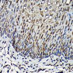 RPL23A Antibody in Immunohistochemistry (Paraffin) (IHC (P))