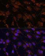 STCH Antibody in Immunocytochemistry (ICC/IF)