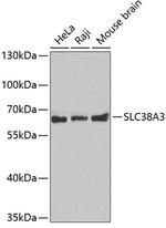 SLC38A3 Antibody in Western Blot (WB)