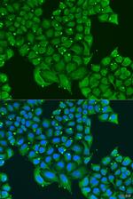 ATPIF1 Antibody in Immunocytochemistry (ICC/IF)